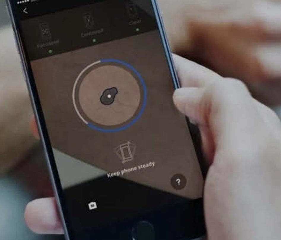 911 ID Biometrics (Bodily Mark Recognition)